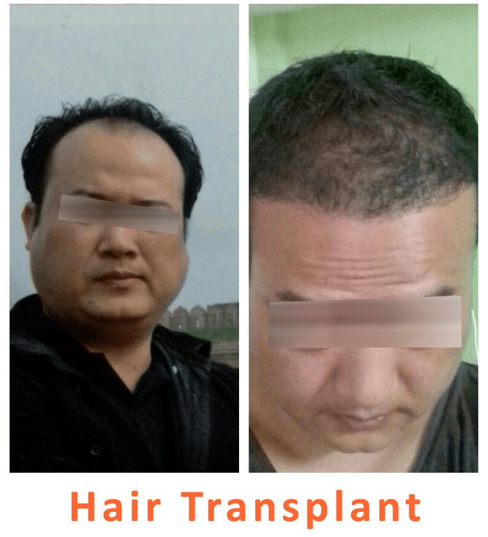 Kalosa - Hair & Cosmetic Clinic - Kalosa - Hair & Cosmetic Clinic