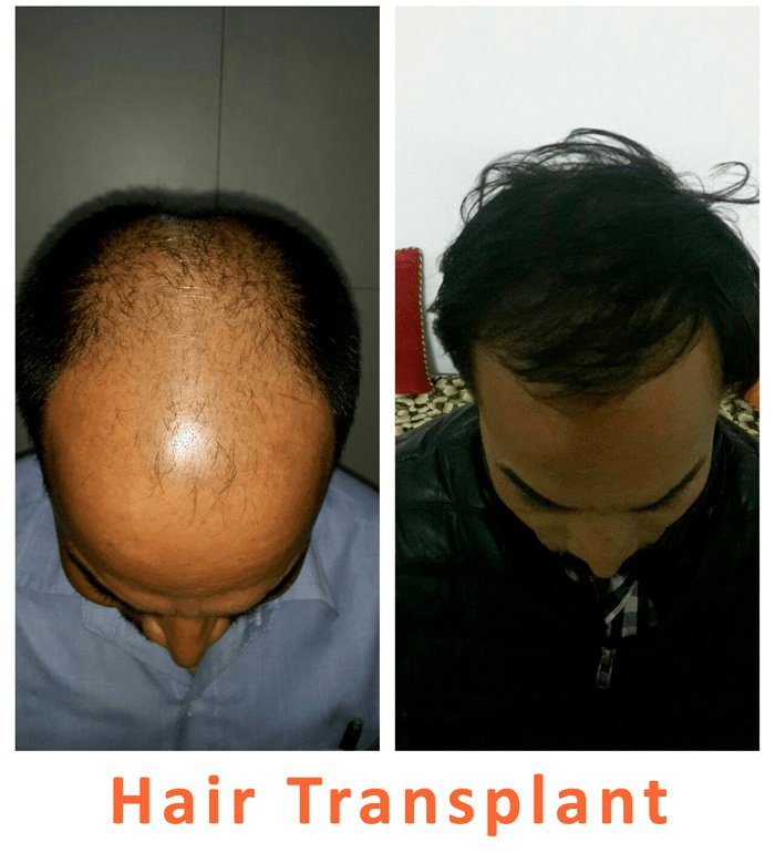 Kalosa - Hair & Cosmetic Clinic - Kalosa - Hair & Cosmetic Clinic