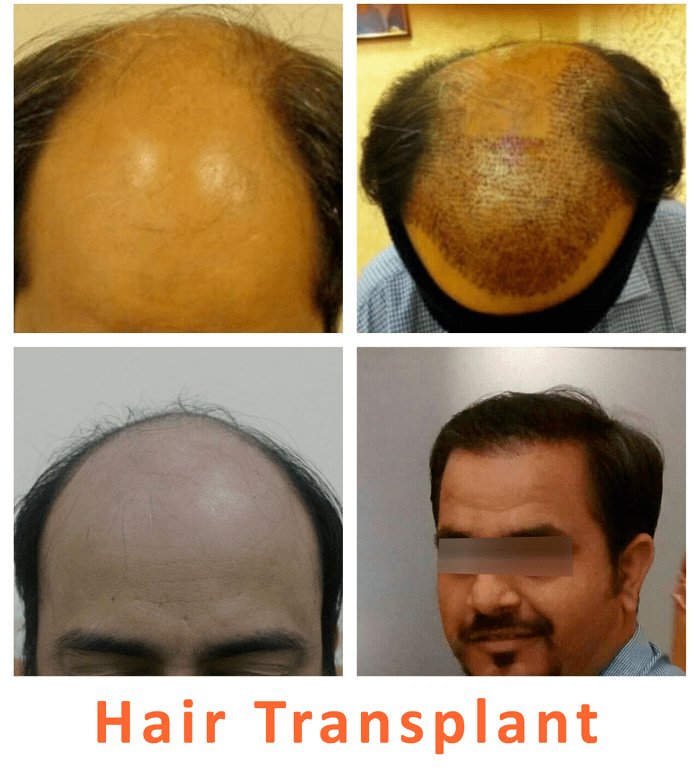 Kalosa - Hair & Cosmetic Clinic - Kalosa - Hair & Cosmetic Clinic