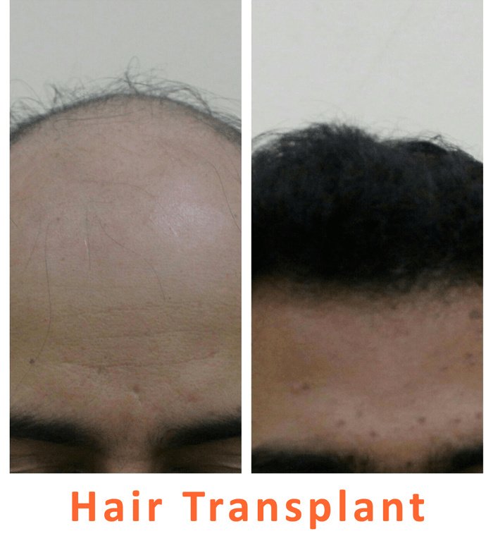 Kalosa - Hair & Cosmetic Clinic - Kalosa - Hair & Cosmetic Clinic