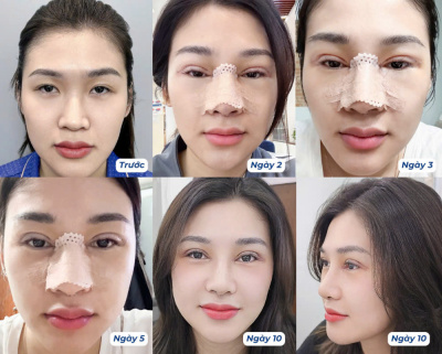 Kangnam Hospital of Aesthetic & Plastic Surgery - Kangnam Hospital of Aesthetic & Plastic Surgery