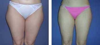 Kapositas - Athens - Kapositas - Athens