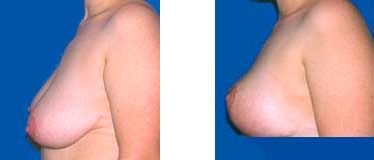 Kapositas - Athens - Kapositas - Athens