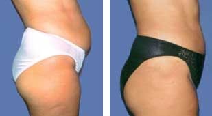 Kapositas - Salonika - Kapositas - Salonika