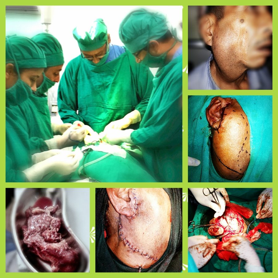 Kathmandu ENT Hospital - Kathmandu ENT Hospital