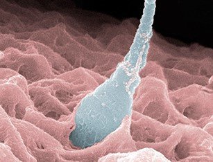 Kathmandu Fertility Center - Kathmandu Fertility Center