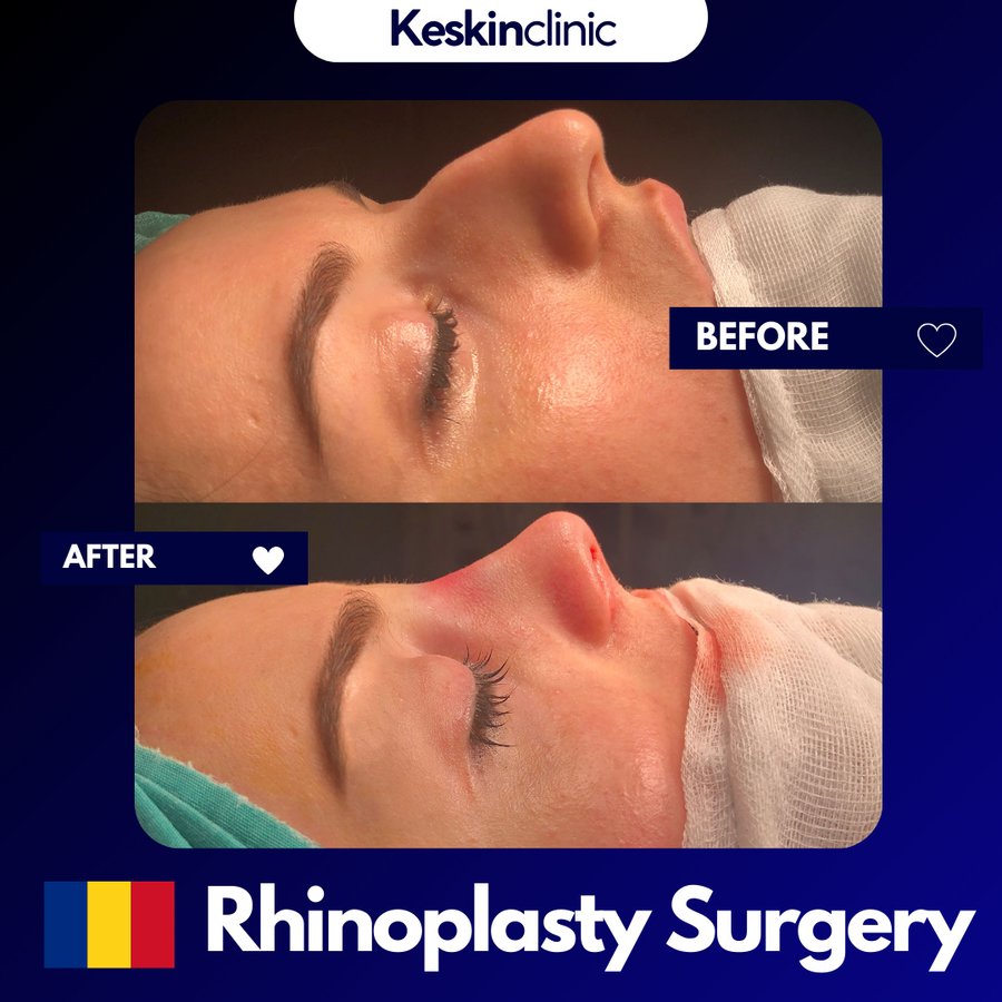 Keskin Clinic - Keskin Clinic