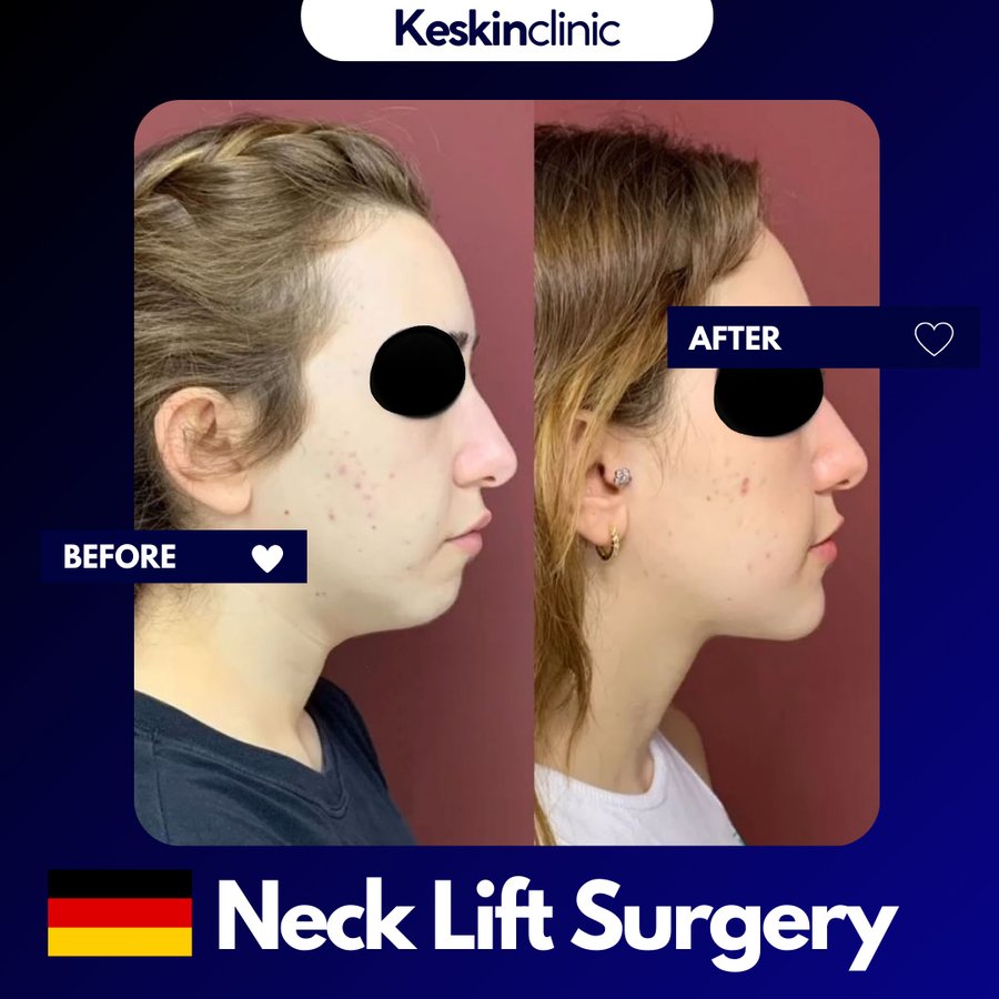 Keskin Clinic - Keskin Clinic