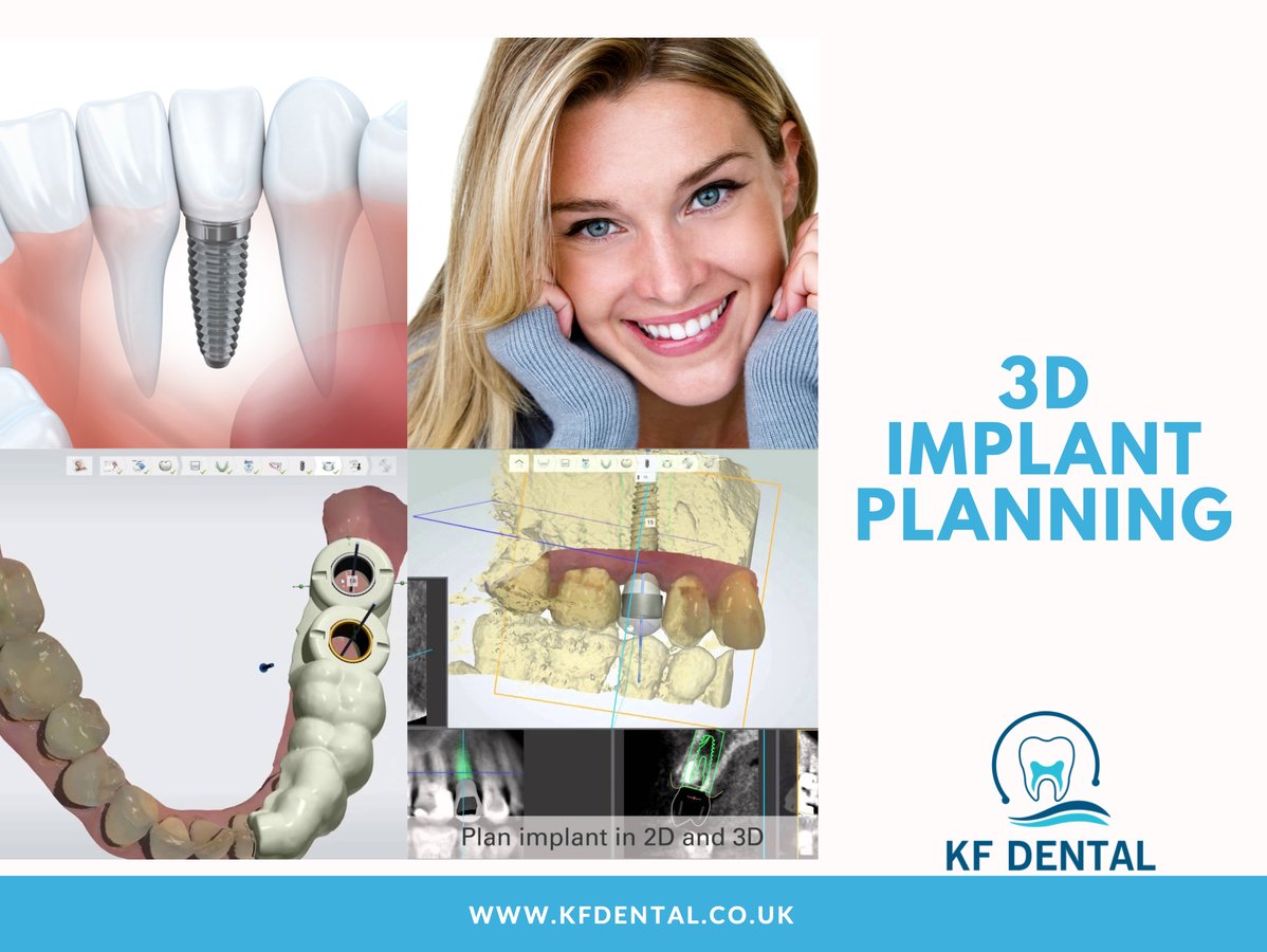 KF Dental - KF Dental