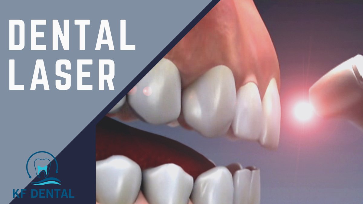 KF Dental - KF Dental