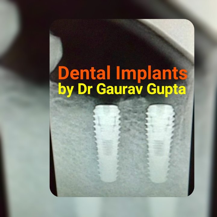 Khandelwal Dental and Skin Clinic - Khandelwal Dental and Skin Clinic