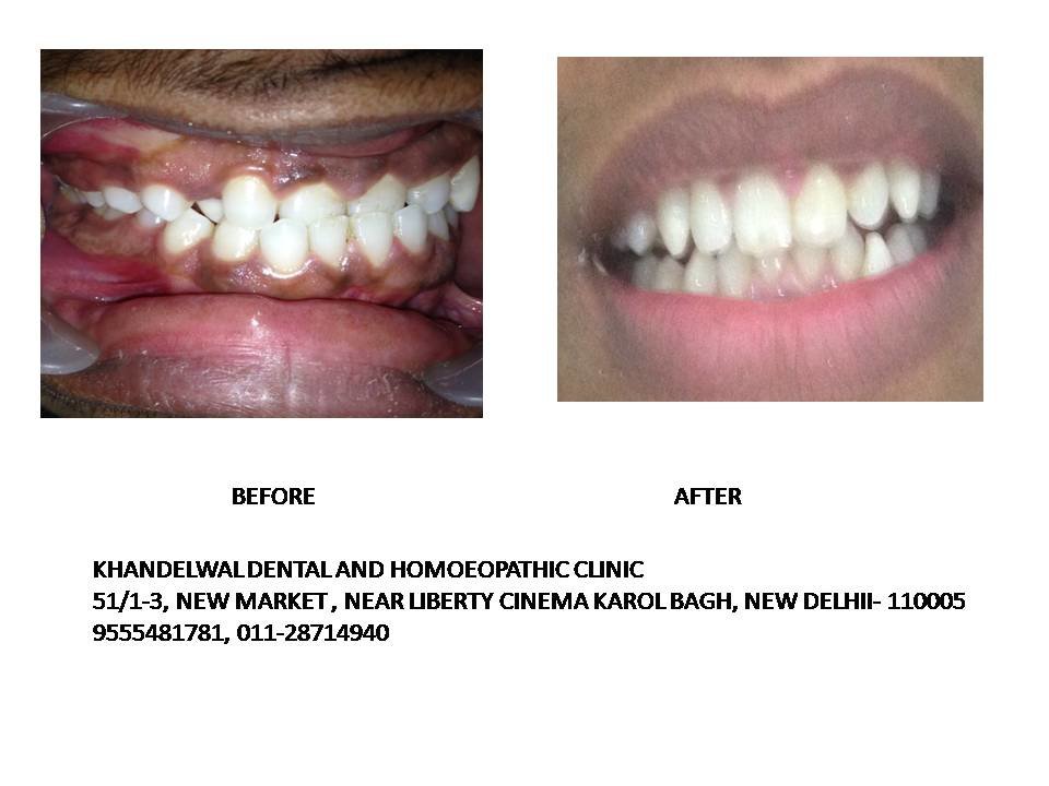 Khandelwal Dental and Skin Clinic - Khandelwal Dental and Skin Clinic