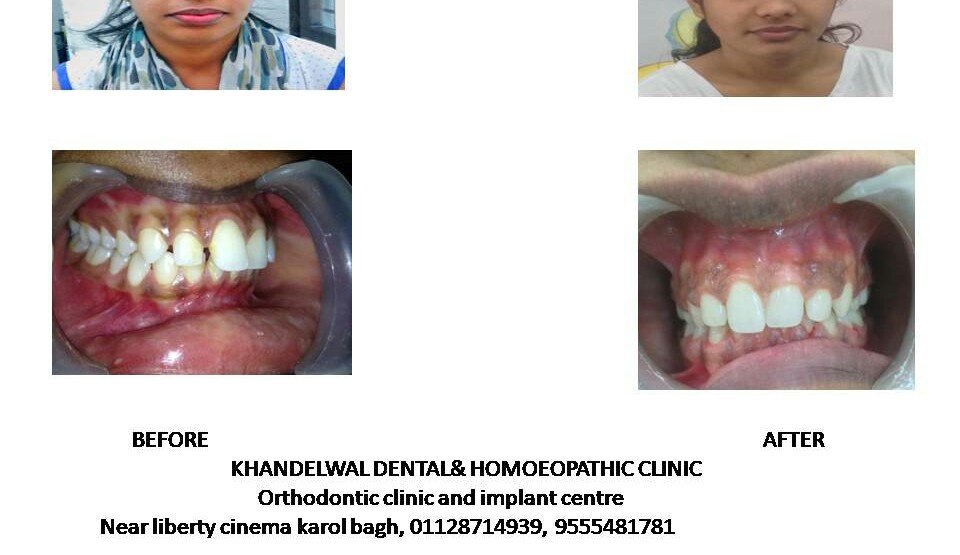 Khandelwal Dental and Skin Clinic - Khandelwal Dental and Skin Clinic