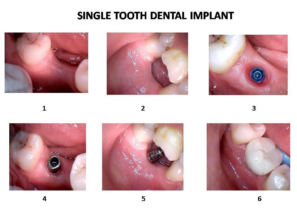 Khandelwal Dental and Skin Clinic - Khandelwal Dental and Skin Clinic