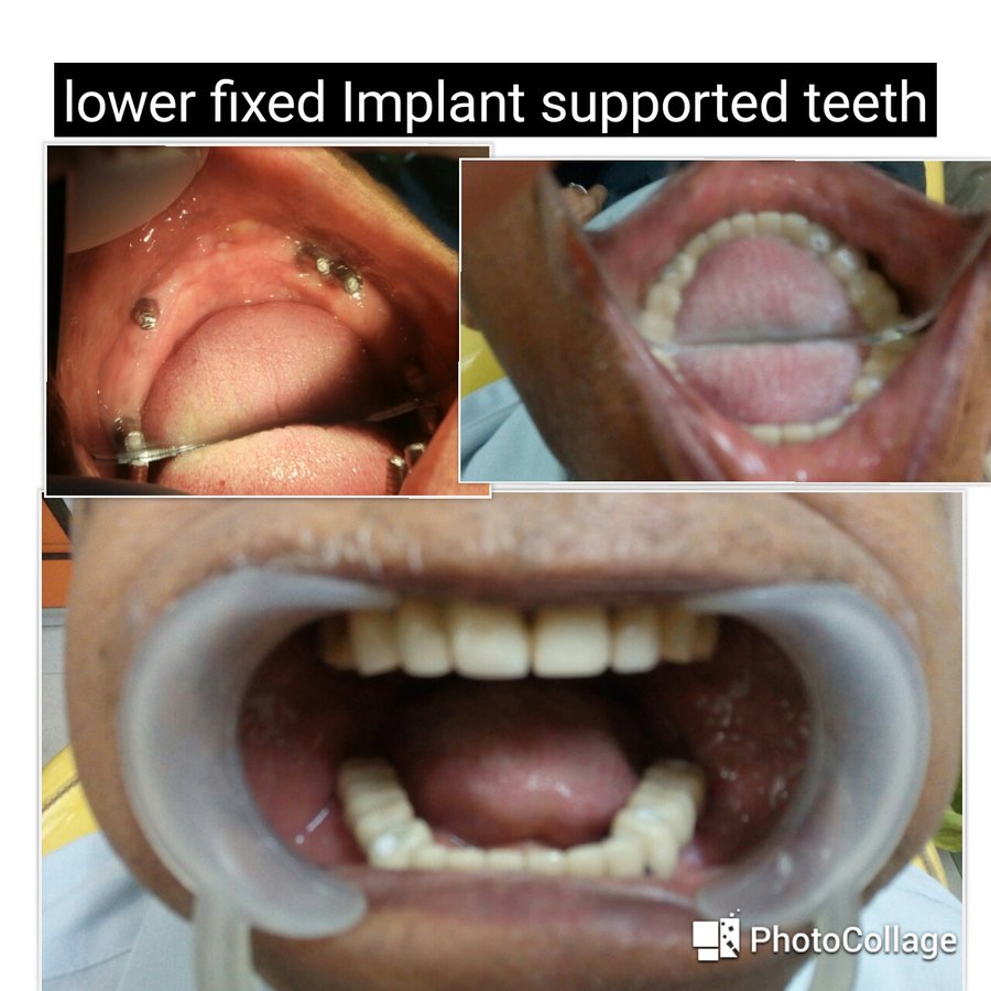 Khandelwal Dental and Skin Clinic - Khandelwal Dental and Skin Clinic