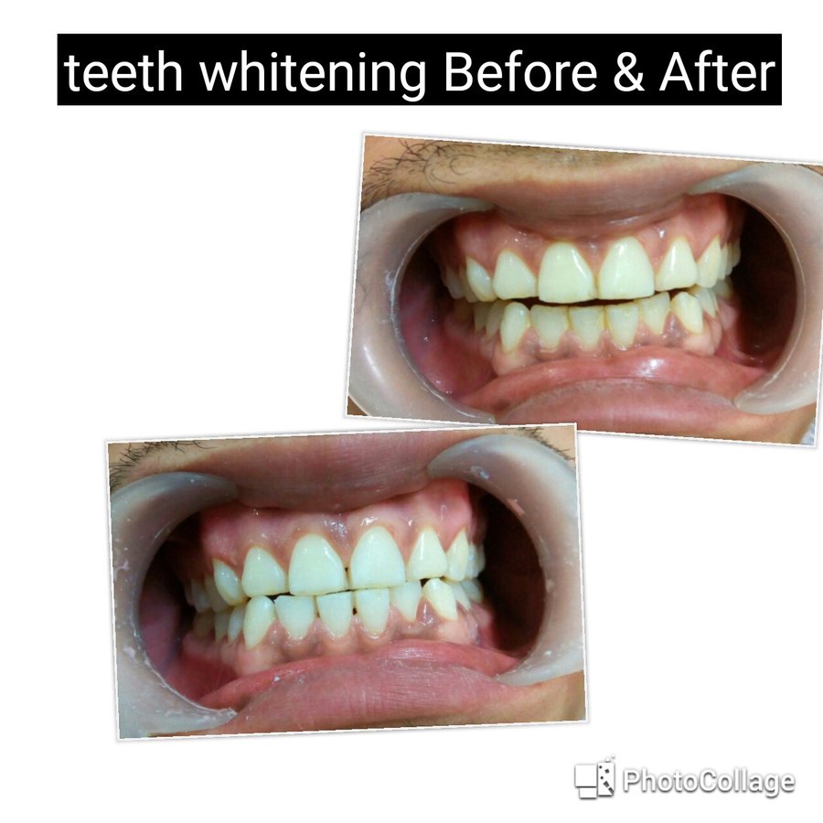 Khandelwal Dental and Skin Clinic - Khandelwal Dental and Skin Clinic