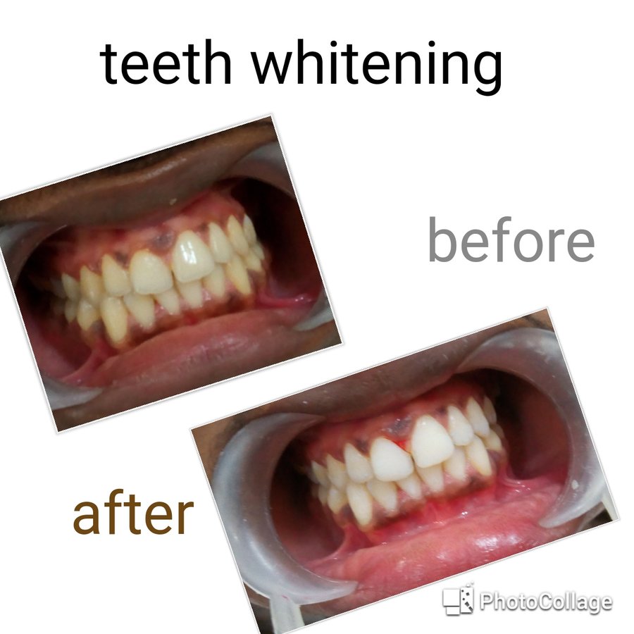 Khandelwal Dental and Skin Clinic - Khandelwal Dental and Skin Clinic