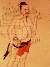 كيلارني الوخز بالإبر - Killarney Acupuncture