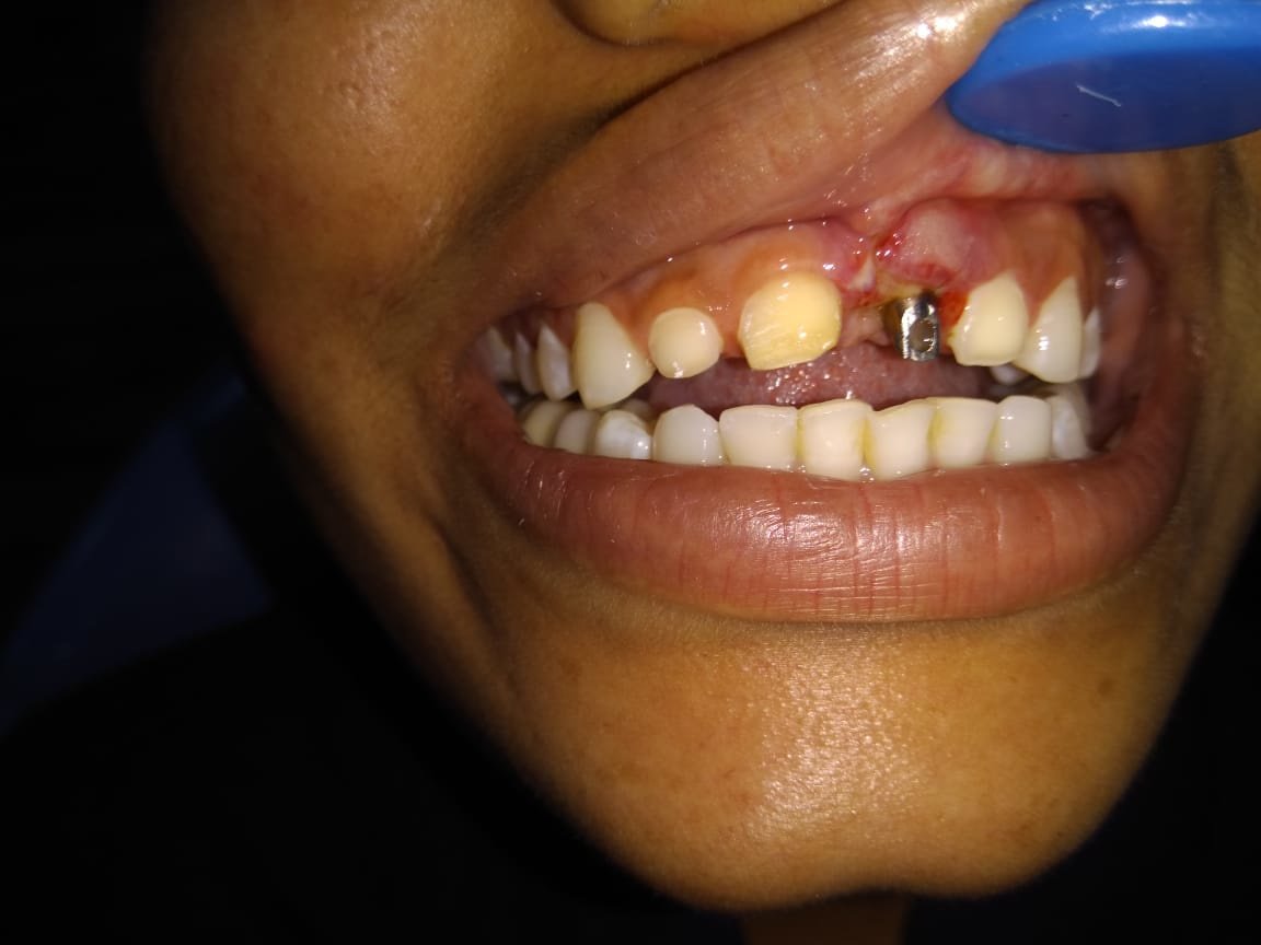 KIMS Dental Care - KIMS Dental Care