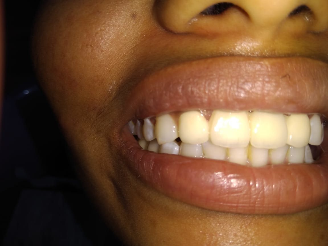 KIMS Dental Care - KIMS Dental Care