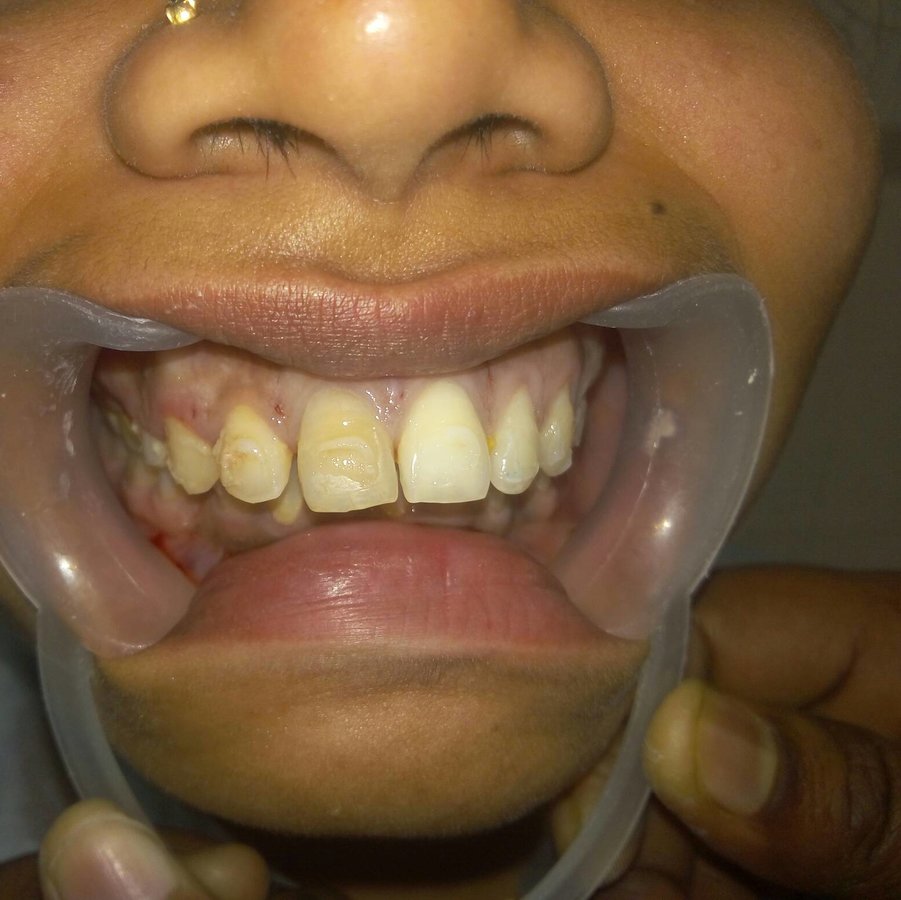 KIMS Dental Care - KIMS Dental Care