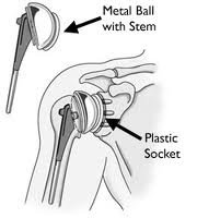 KIMS - Orthopaedic Hospital India - KIMS - Orthopaedic Hospital India