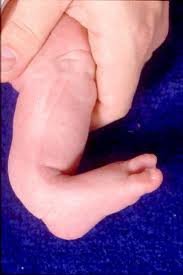 KIMS - Orthopaedic Hospital India - KIMS - Orthopaedic Hospital India