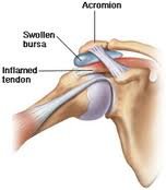 KIMS - Orthopaedic Hospital India - KIMS - Orthopaedic Hospital India