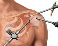 KIMS - Orthopaedic Hospital India - KIMS - Orthopaedic Hospital India