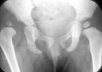 KIMS - Orthopaedic Hospital India - KIMS - Orthopaedic Hospital India