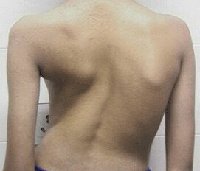 KIMS - Orthopaedic Hospital India - KIMS - Orthopaedic Hospital India