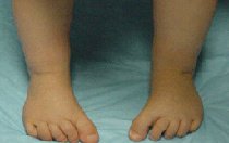 KIMS - Orthopaedic Hospital India - KIMS - Orthopaedic Hospital India