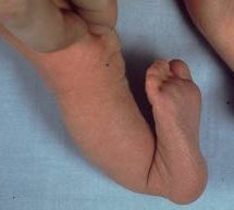 KIMS - Orthopaedic Hospital India - KIMS - Orthopaedic Hospital India