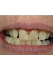 عيادة كيران لطب الأسنان-Vypeen - Kirans Dental Clinic-Vypeen