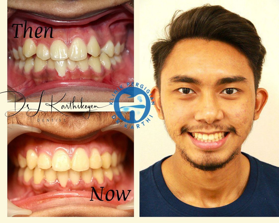 Klinik Pergigian Dr. Karthi - Klinik Pergigian Dr. Karthi