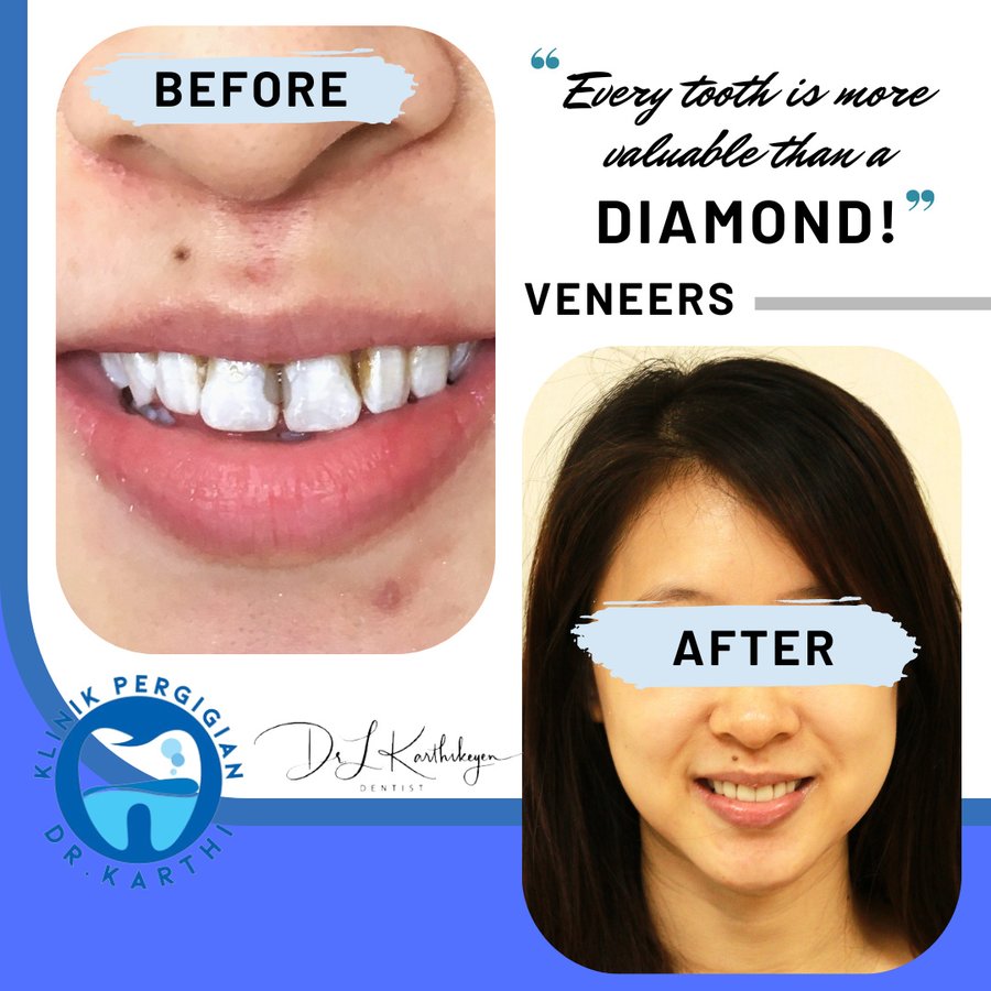 Klinik Pergigian Dr. Karthi - Klinik Pergigian Dr. Karthi