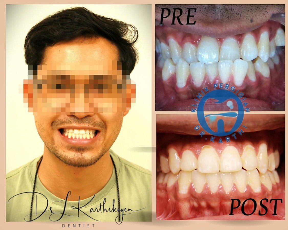 Klinik Pergigian Dr. Karthi - Klinik Pergigian Dr. Karthi