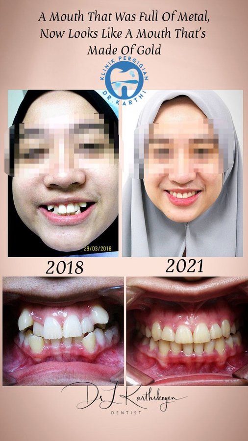 Klinik Pergigian Dr. Karthi - Klinik Pergigian Dr. Karthi