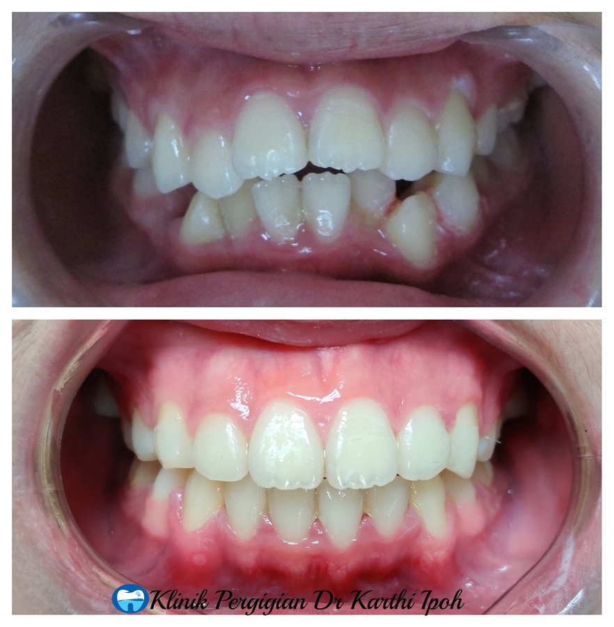 Klinik Pergigian Dr. Karthi - Klinik Pergigian Dr. Karthi