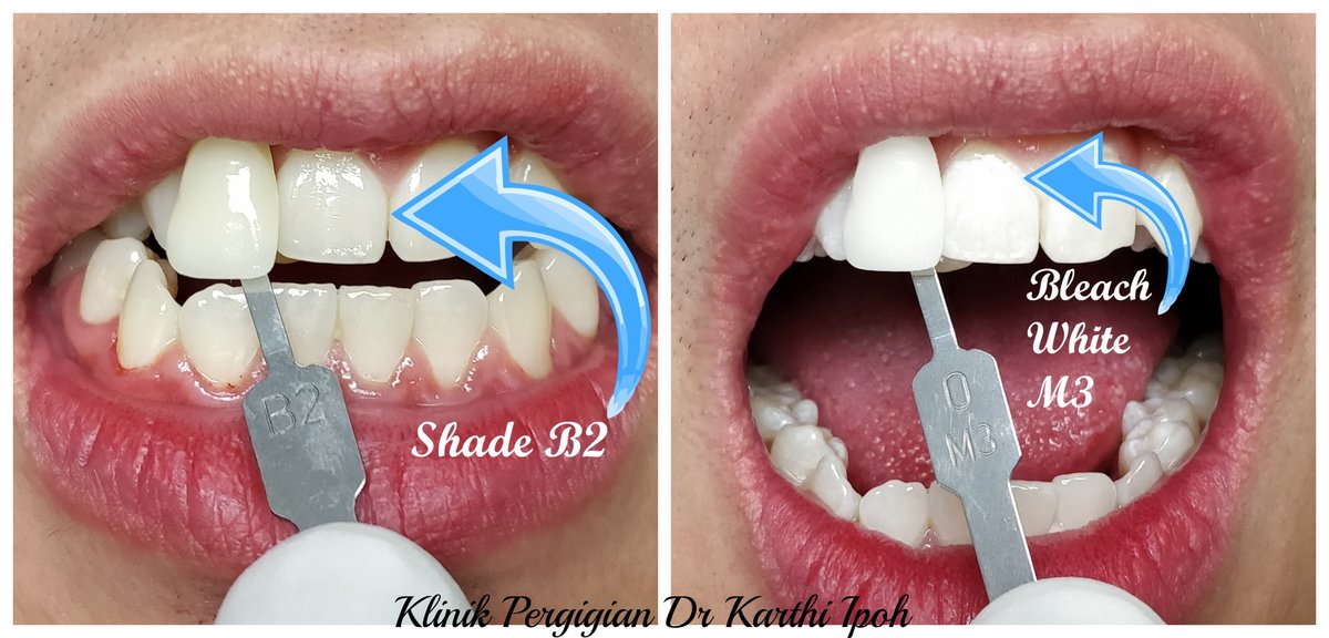 Klinik Pergigian Dr. Karthi - Klinik Pergigian Dr. Karthi