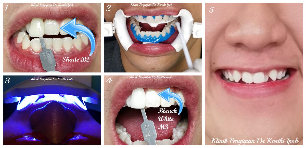 Klinik Pergigian Dr. Karthi - Klinik Pergigian Dr. Karthi