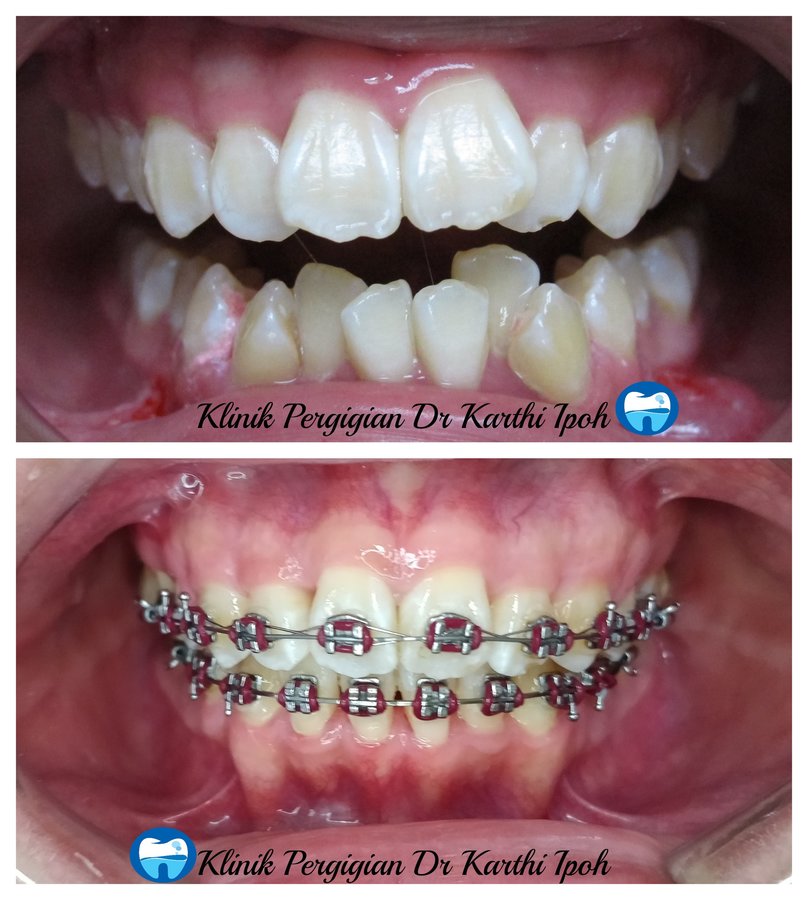 Klinik Pergigian Dr. Karthi - Klinik Pergigian Dr. Karthi