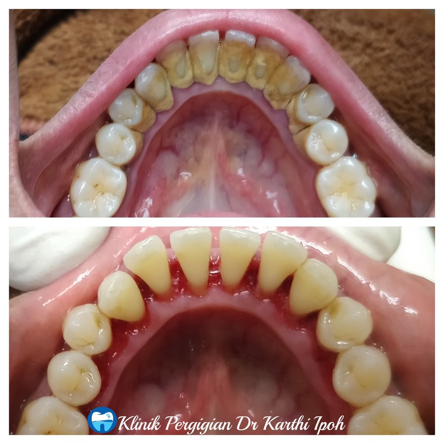 Klinik Pergigian Dr. Karthi - Klinik Pergigian Dr. Karthi