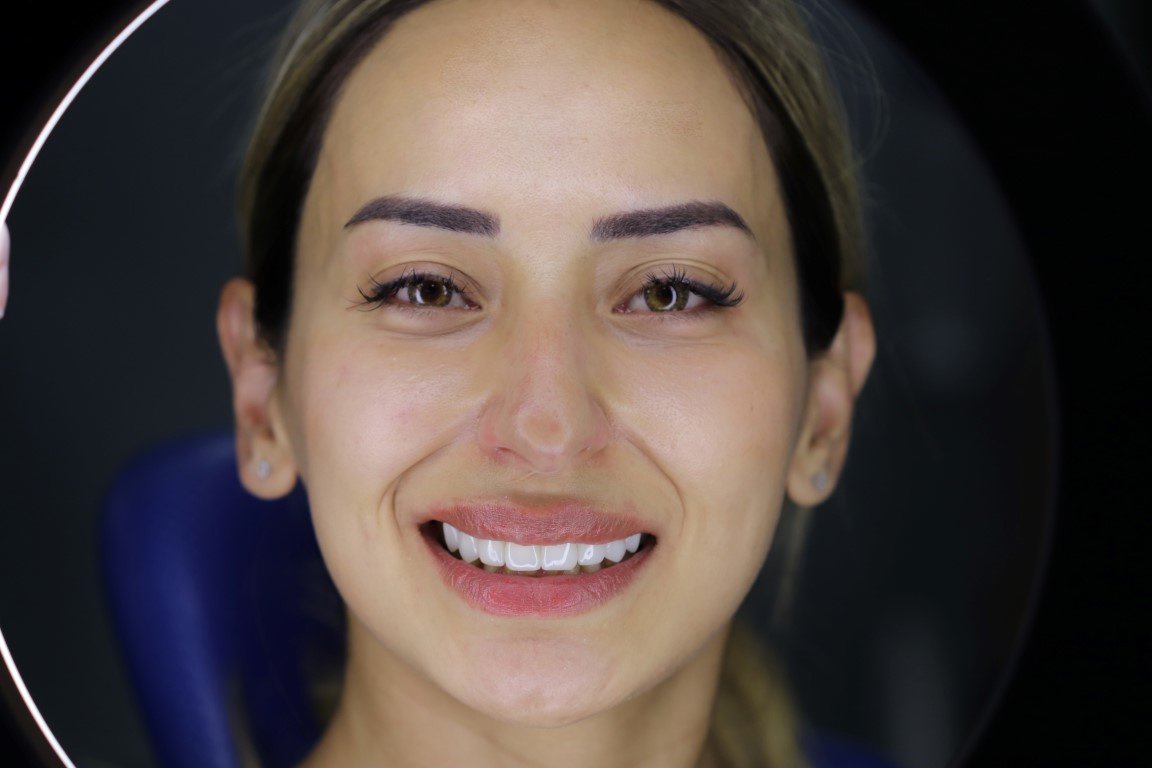 عيادة كوراي لطب الأسنان - Koray Dental Clinic
