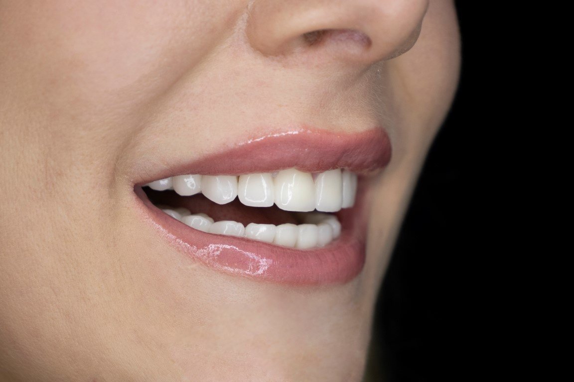 عيادة كوراي لطب الأسنان - Koray Dental Clinic