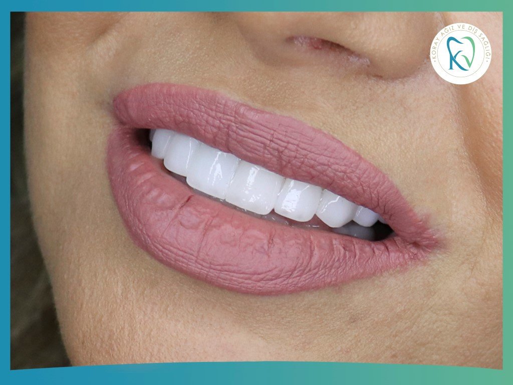 عيادة كوراي لطب الأسنان - Koray Dental Clinic