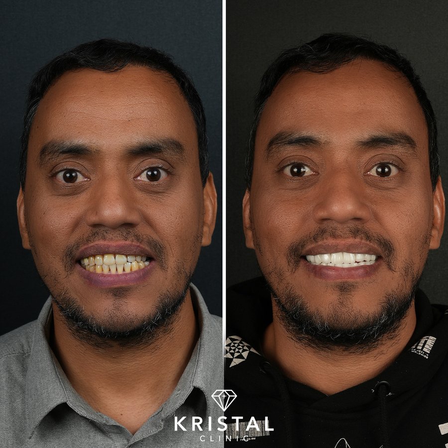 Kristal Clinic - Kristal Clinic