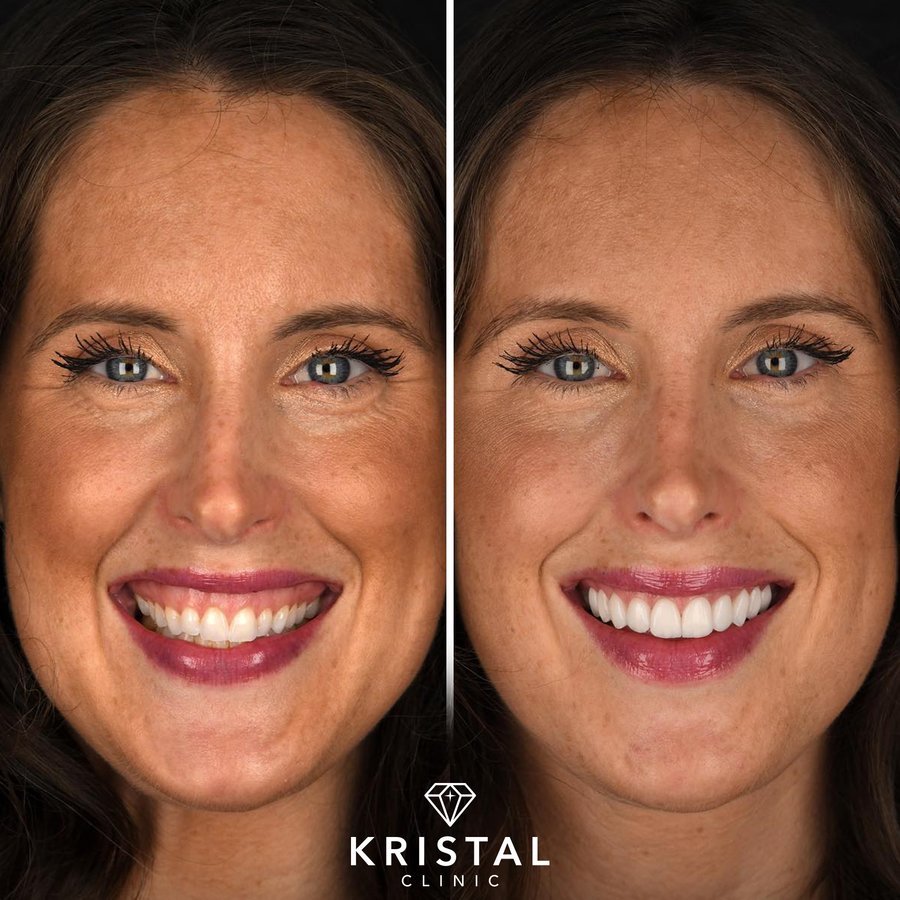 Kristal Clinic - Kristal Clinic