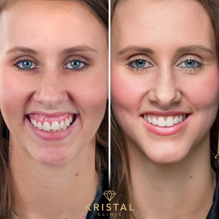 Kristal Clinic - Kristal Clinic