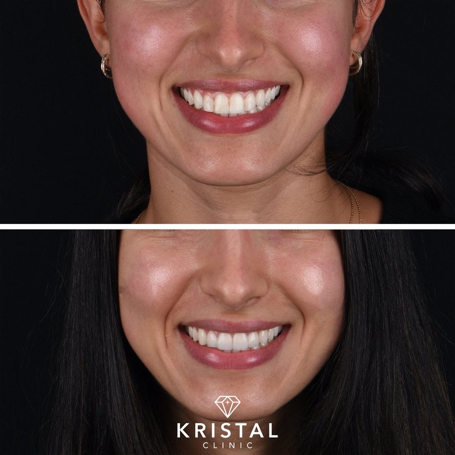 Kristal Clinic - Kristal Clinic